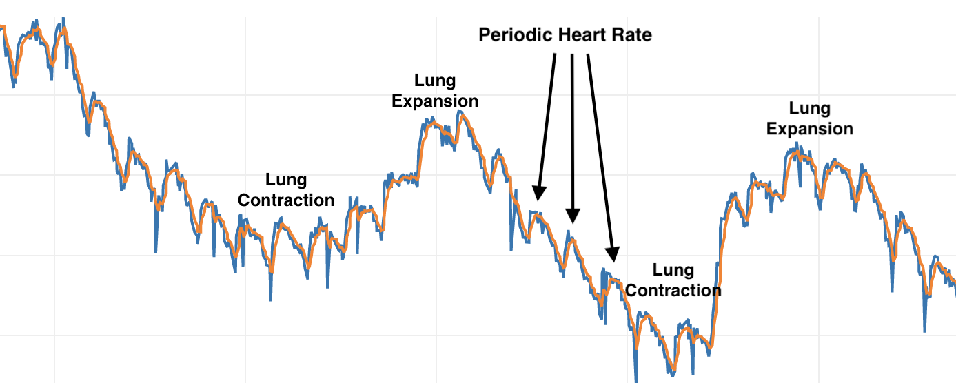 Time series data of lungs and heart.